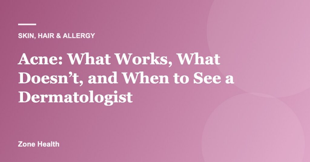 Acne: What Works, What Doesn’t, and When to See a Dermatologist